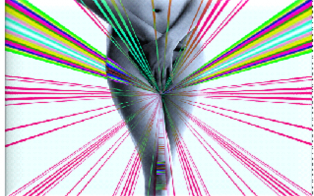 Atrofia vulvo vaginale in postmenopausa: atteggiamento delle donne italiane